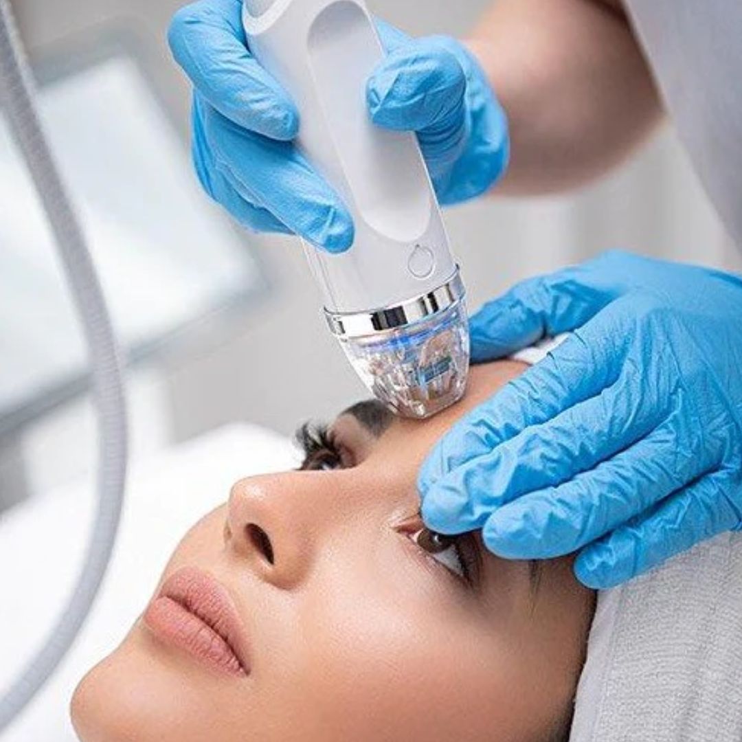 Secret RF Microneedling