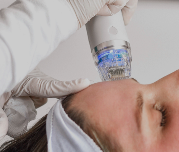 3 SECRET RF TREATMENTS FOR FACE & NECK